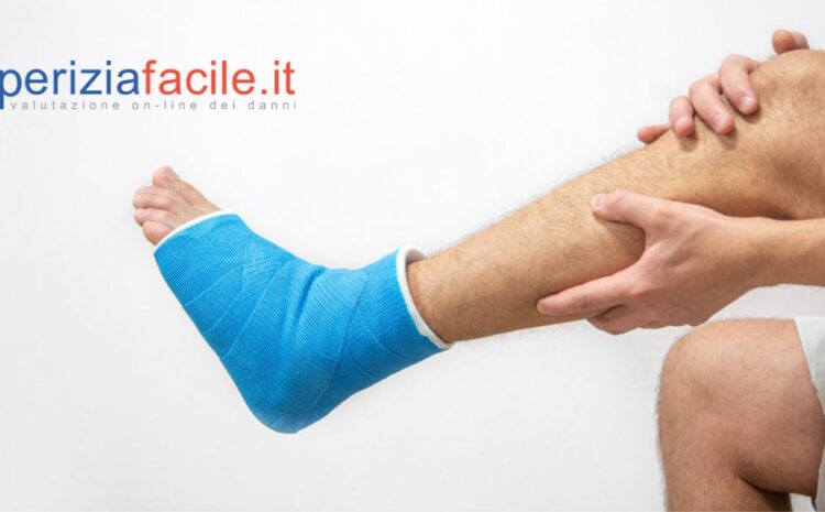  Infortunio sul lavoro con doppia frattura tibio-tarsica